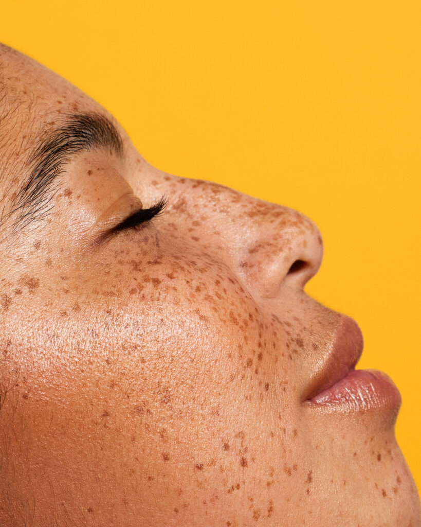 Image of a model for Bioderma campaign